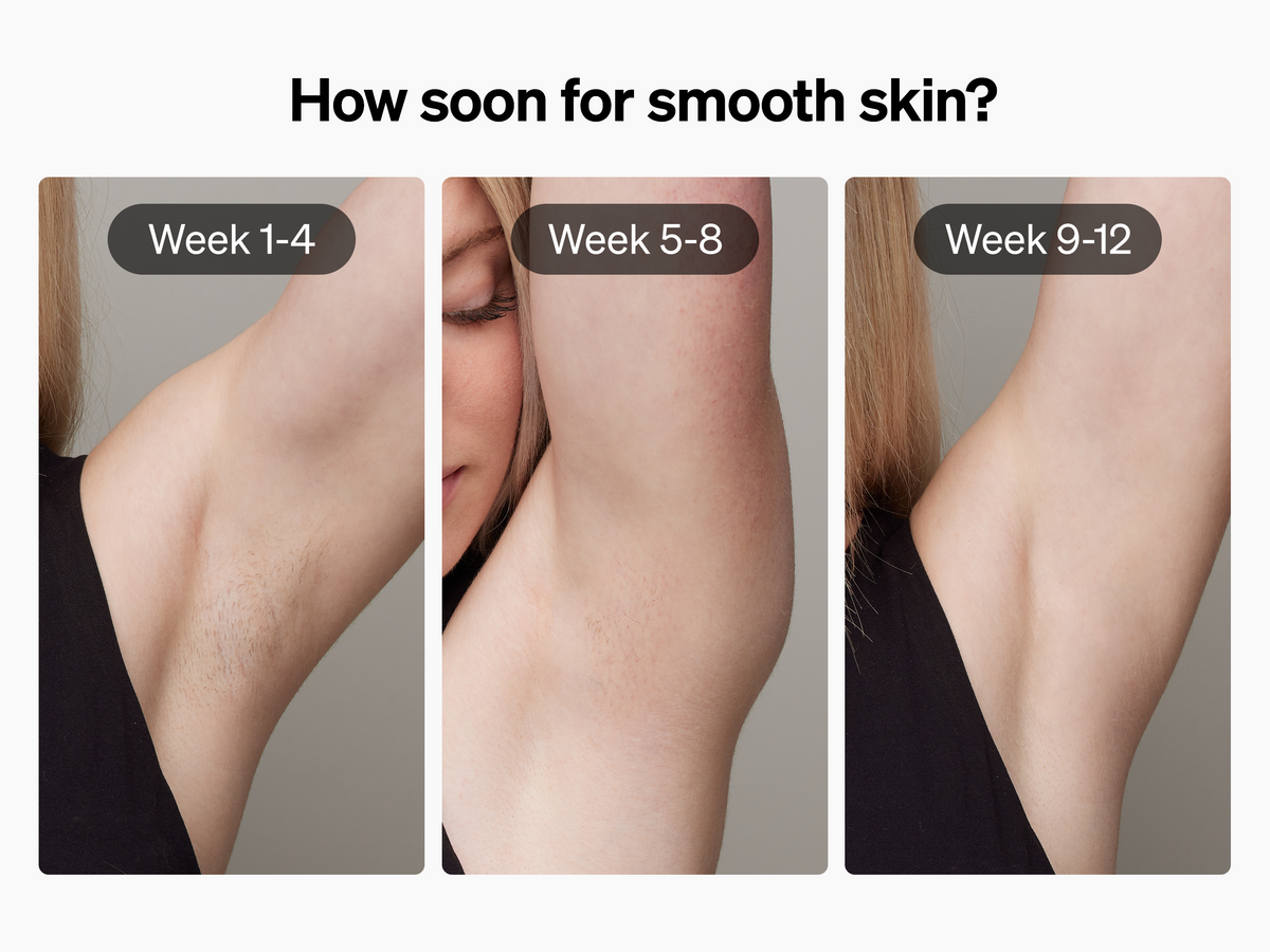 Ulike Sapphire Air+ IPL Hair Removal Handset