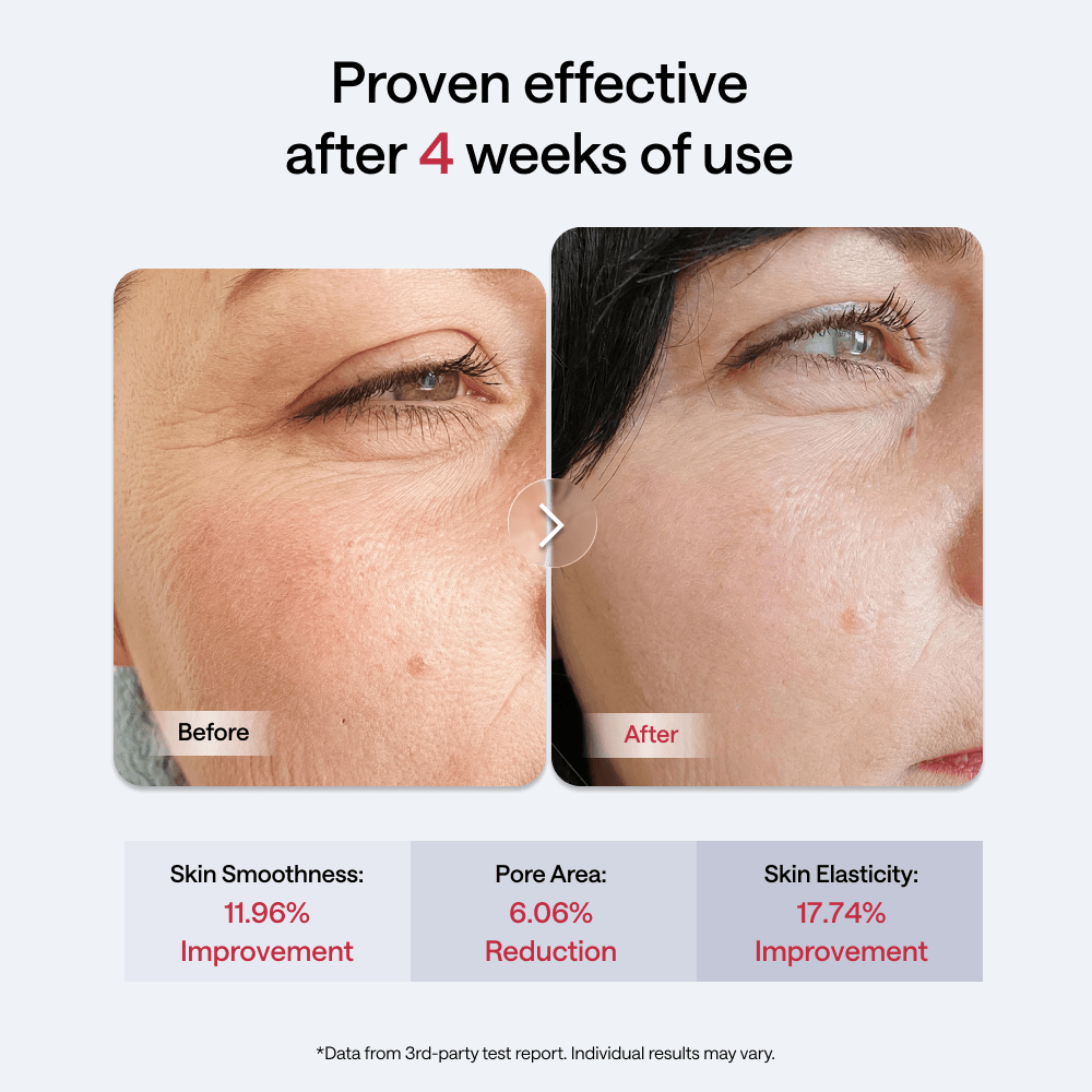JMOON by Ulike Transdermal EM50