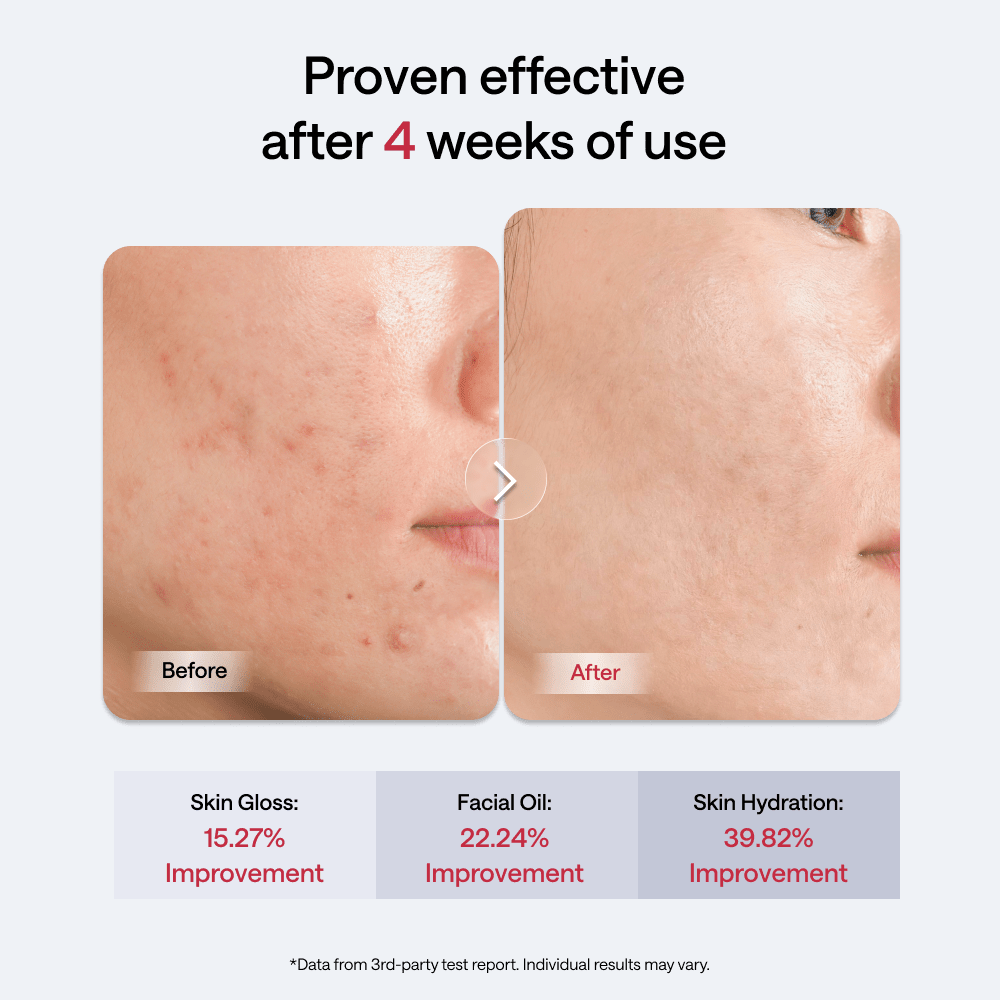 JMOON by Ulike Transdermal EM50